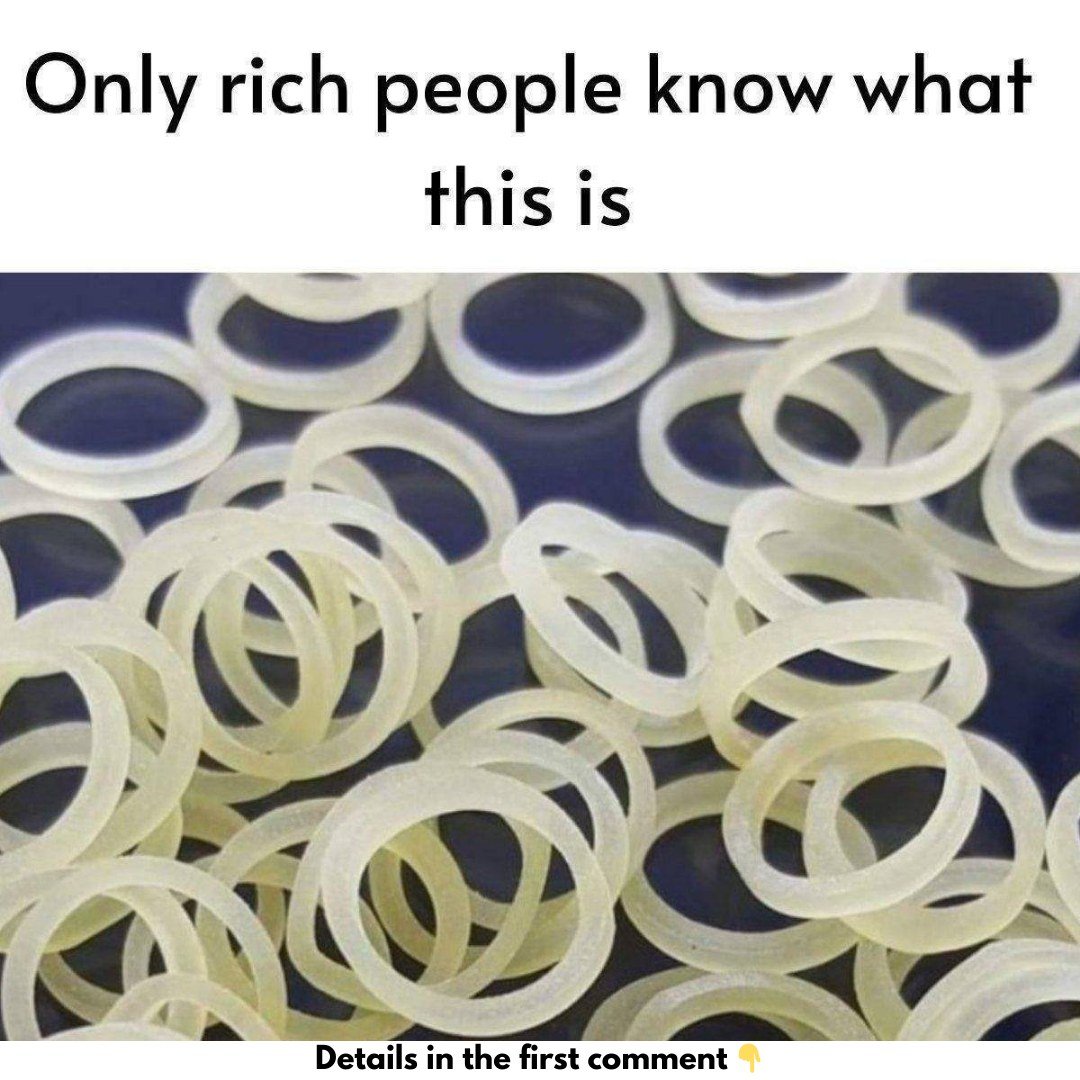 The Secret Power of Elastic Bands in Orthodontics Only.rich people will know