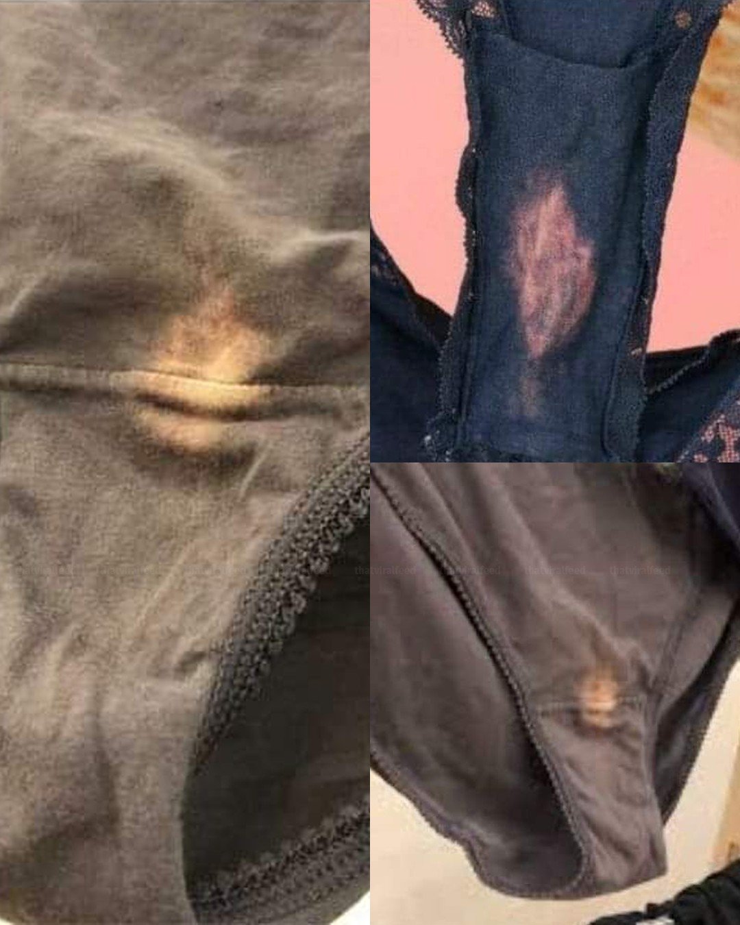 If you find a “bleach” patch in your underwear, you had better know what it means